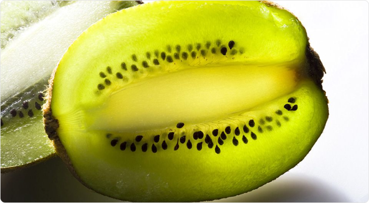 frutta che fa andare in bagno kiwi